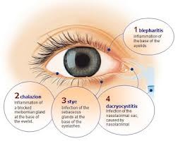 boli ale pleoapelor oftalmologie